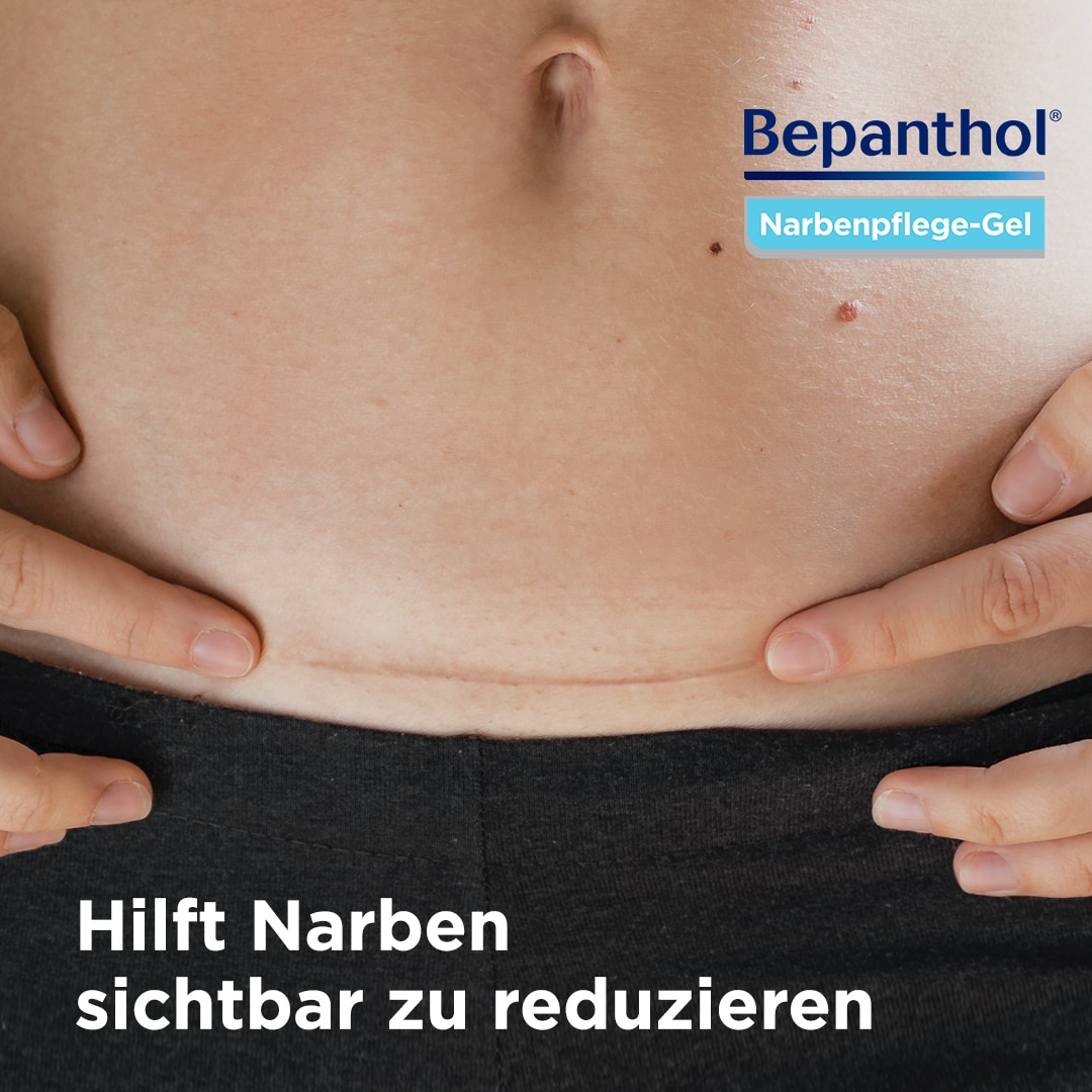 Bepanthol® Narbenpflege-Gel